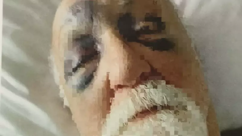 70 Yaşındaki Emlakçı Cemil Tümayman, Kiracıları Tarafından Darp Edildi