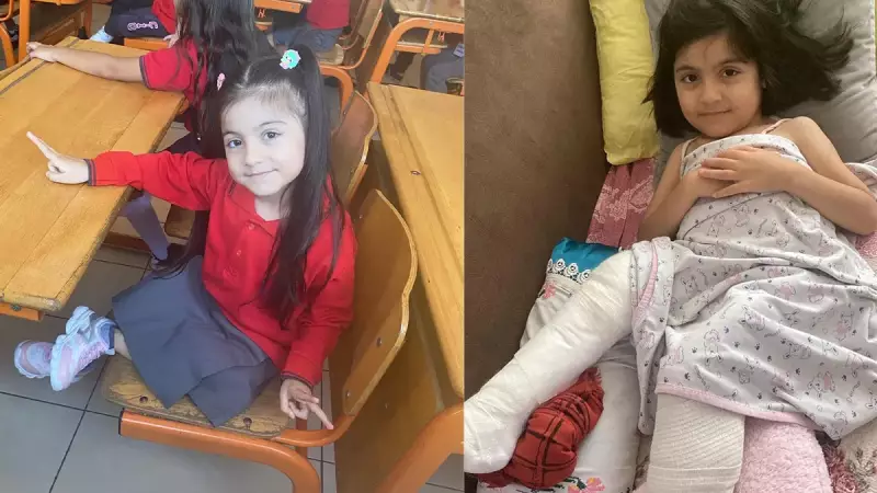 Cam Kemik Hastası Nilüfer (6) Acil Ameliyat Bekliyor: Ailesi Yardım İstiyor