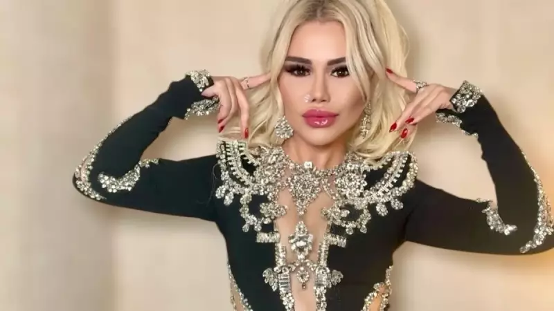 Ceylan'dan Estetik İtirafı: Ekranda Yüzüm Şiş Çıkıyor, Dolgu Asla Yaptırmam