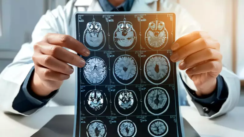 İnmede Yanlış Müdahale Ölümcül Olabilir: Aspirin Vermeyin, 112'yi Arayın!