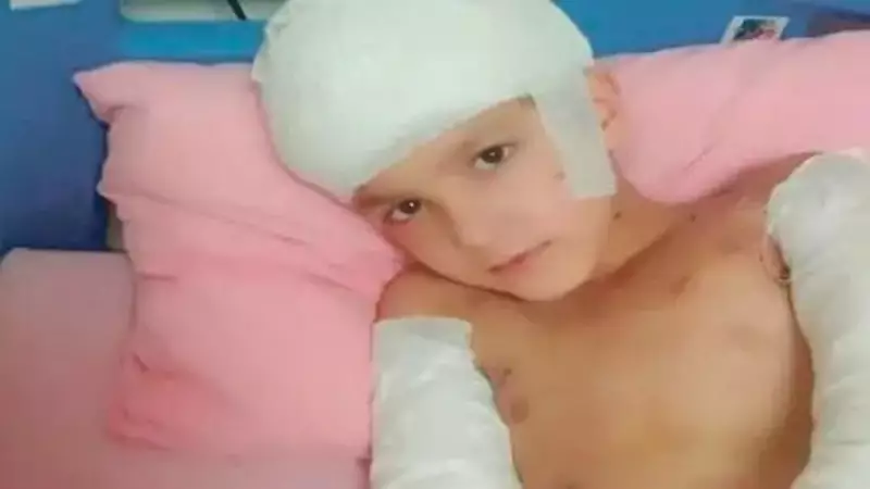 Sokak Köpeği Saldırısında Emkar Karar: 5 Milyon TL Tazminat