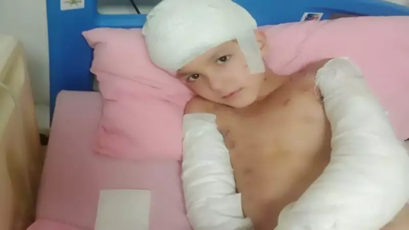 Sokak Köpeği Saldırısında Emsal Karar: Aileye 5 Milyon TL Tazminat