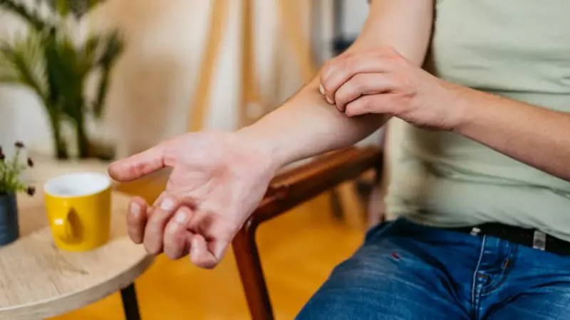 Yemekten Sonraki 90 Dakikaya Dikkat! Ürtiker Hayatınızı Tehlikeye Atabilir