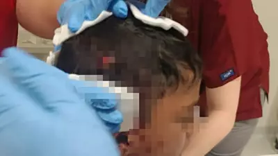 Ankara'da Sokak Köpeği Saldırısı: 8 Yaşındaki Çocuk Yaralandı!