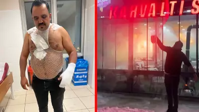 Sivas'ta -20 Derecede Kaynar Su Deneyi Faciayla Bitti: Esnaf Hastanelik Oldu!