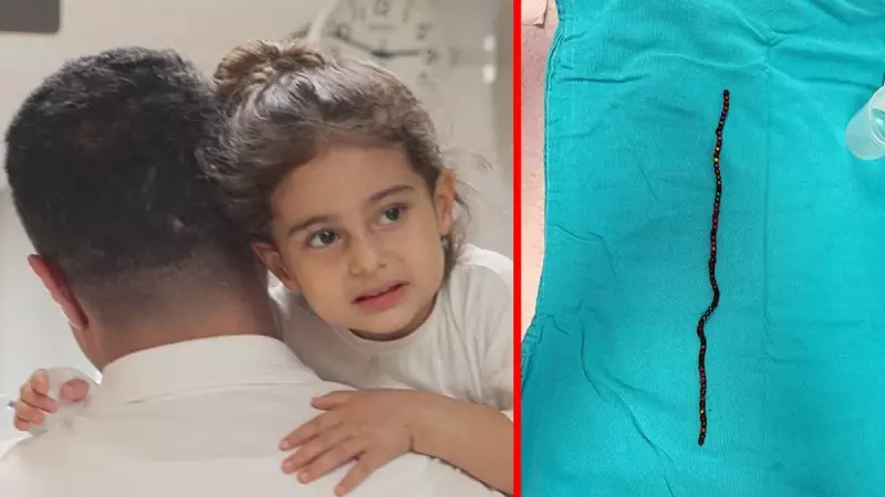 3 Yaşındaki Çocuğun Karnından 66 Adet Mıknatıs Çıktı! Doktorlar Şoke Oldu