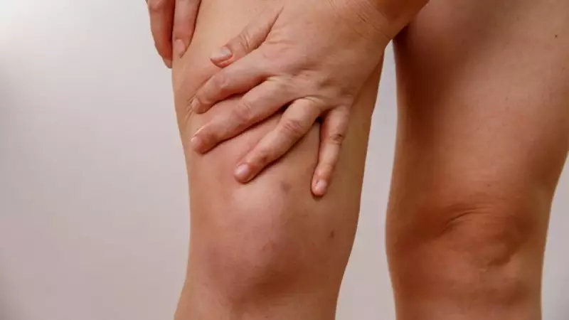 Bacaklarınızdaki Şişlik ve Ağrıya Dikkat! Lipödem Hastalığı Kadınları Tehdit Ediyor