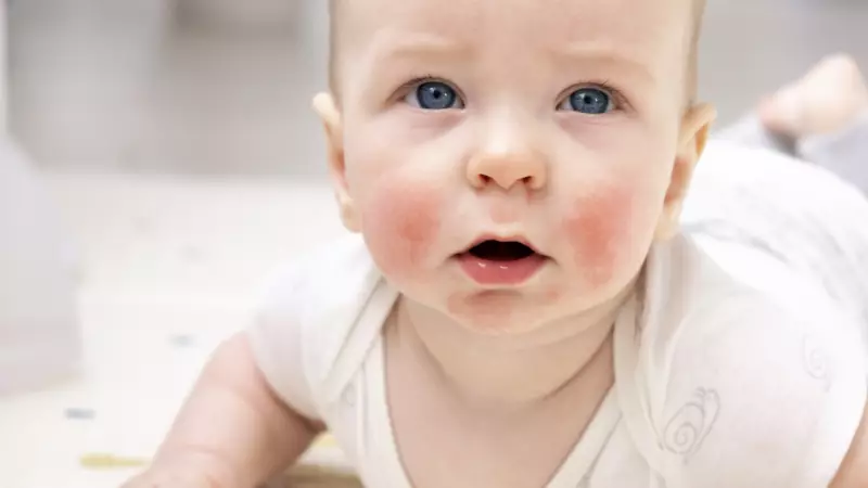 Bebeklerde İsilik Sorunuyla Başa Çıkmanın Püf Noktaları: Rahat Bir Yaz İçin!
