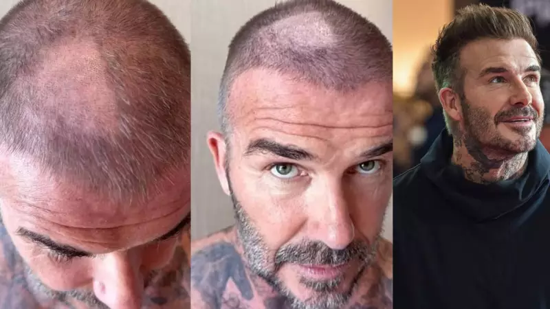 David Beckham'ın Şaşırtan Trafik Kazası: Ünlü Yıldızın Başına Gelenler!