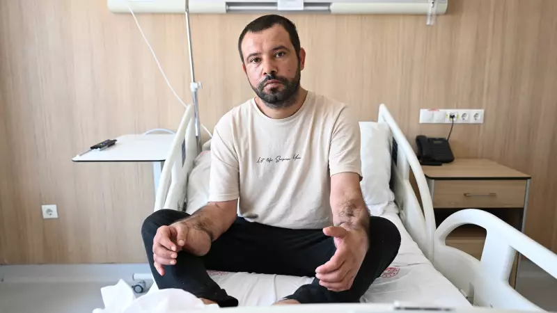 Dokular Yenilendi, Hayat Kurtarıldı: Elektrik Çarpması Sonrası Dört Uzuv Kaybından Kurtulan İşçinin Mucizevi Hikayesi