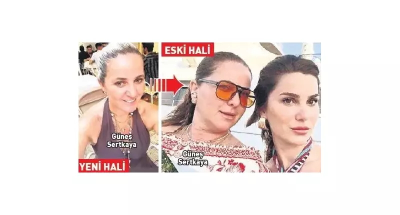 Estetik Operasyonla 10 Yaş Gençleşen Kayınvalide Görenleri Şaşkına Çevirdi!