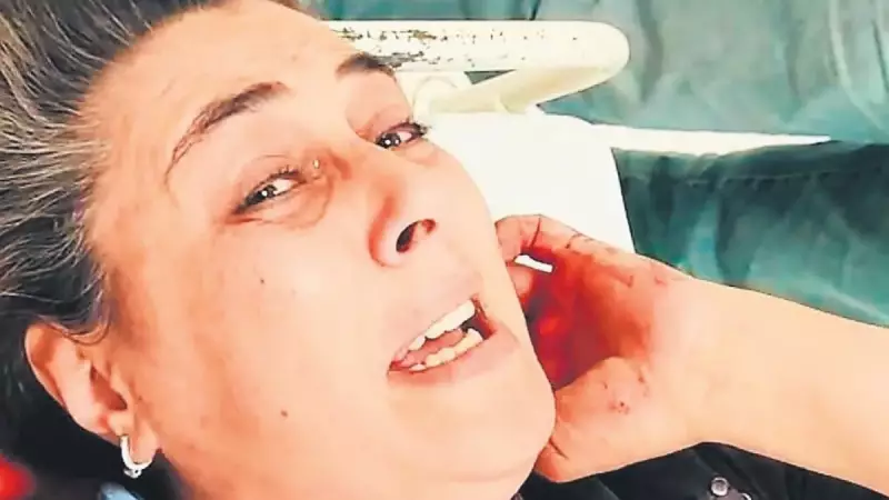 Kocasını Bıçaklayan Kadın Serbest Kaldı: Şiddetin Korkunç Yüzü