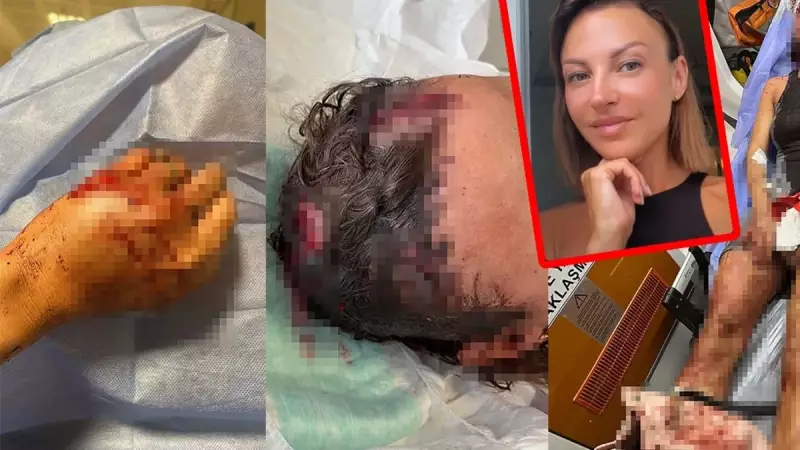 Ukrayna Kökenli Türk Vatandaşı İryna'nın Çarpıcı İtirafı: 'Eşim Beni Öldürmeye Geldi!'