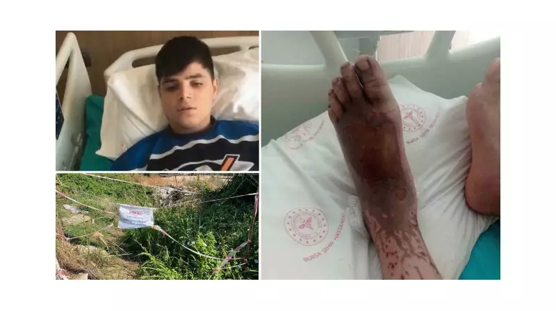 14 Yaşındaki Çocukta Asit Çamuru İddiası: İstanbul'da Korkunç Olay!