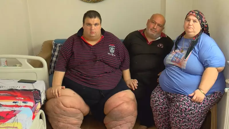 270 Kilo Ağırlığındaki Mehmet'in Çığlığı: '15 Aydır Evden Çıkamıyorum, Yardım Edin!'