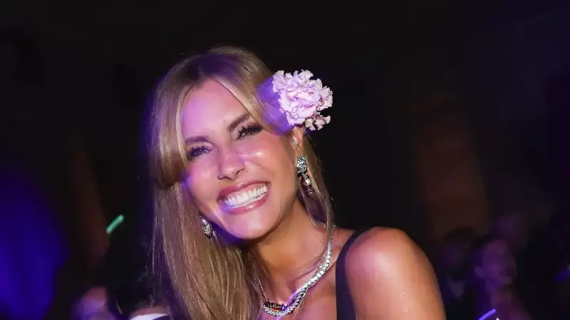 Çağla Şıkel'in Yeni Hobisi Vücudunu Morluk İçinde Bıraktı! İşte O Şok Eden Görüntüler