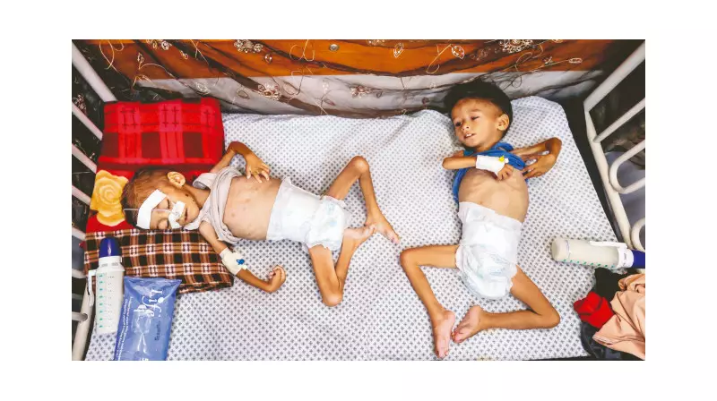 Açlık Krizi Dünyayı Felç Ediyor: Milyonların Hayatı Tehlikede!