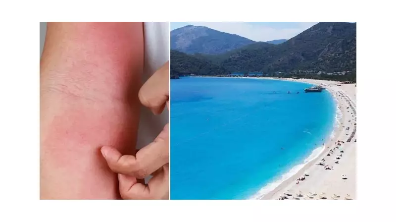 Antalya'da Deniz Suyu Isındı, Vatandaşlar Kaşıntıdan Yakınıyor! Uzmanlar Uyarıyor