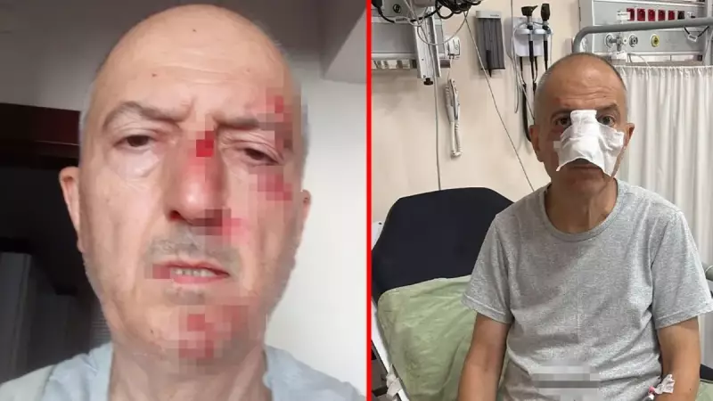 Boşanma Sürecindeki Adamın Başına Gelenler: Evden Atıldı, Burnu Kırıldı!