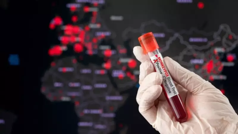 DSÖ Alarm Verdi: Maymun Çiçeği Virüsüne Karşı Aşı Şart!