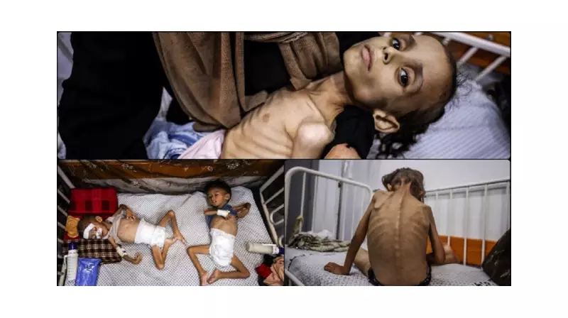 Gazze'deki Doktorların Çığlığı: 'Kitaplarda Okuduğumuz Kâbus Şimdi Gözlerimizin Önünde'