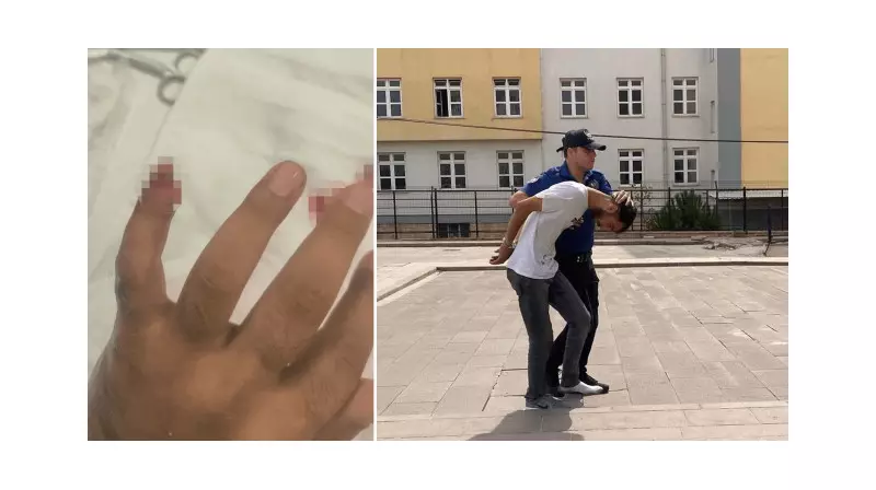 Genç Uyuşturucu Operasyonunda Polise Korkunç Saldırı: Serçe Parmağını Isırıp Kopardı!
