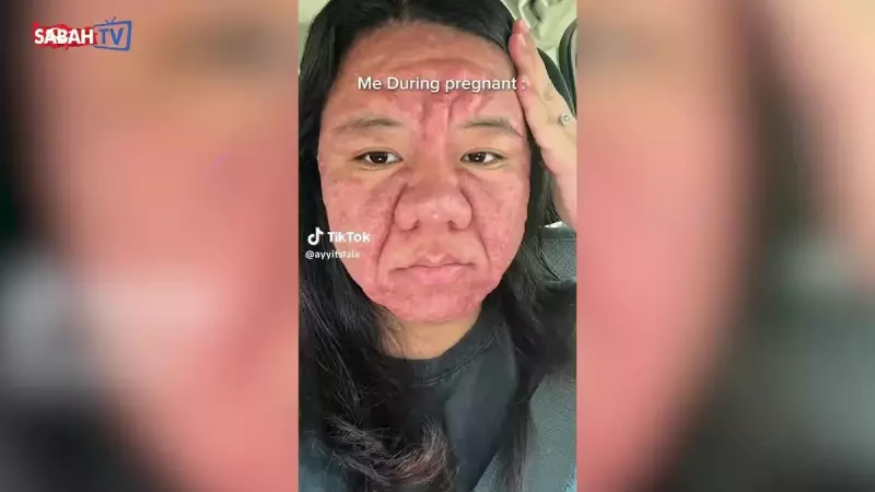 Hamilelik Döneminde Yüzü Tanınmayacak Hale Geldi! 'Aniden Yaşlandım' Dediği Video Sosyal Medyayı Salladı