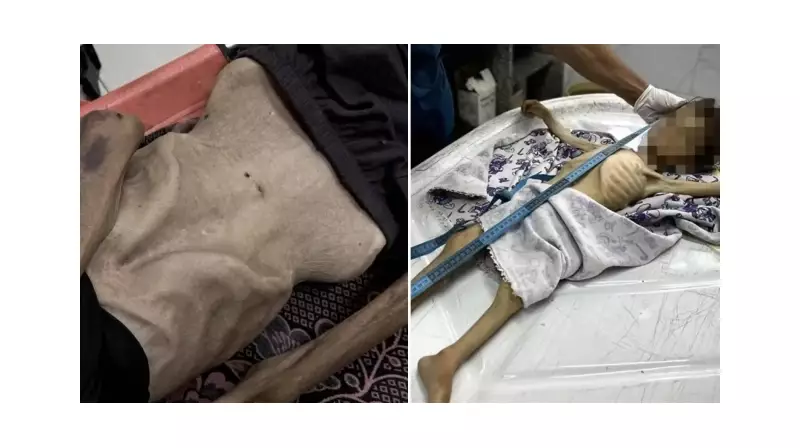 İngiliz Patologdan Çarpıcı İtiraf: 'Gazze'de Gördüklerim İnsanlık Dramının Boyutunu Gözler Önüne Serdi'