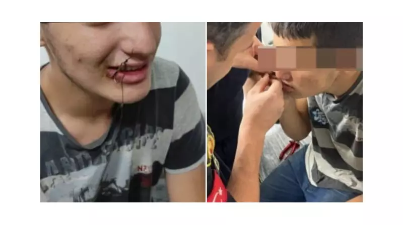 Oltaya Takılan Çocuğu İtfaiye Kurtardı: Balık İğnesiyle Oynarken Başına Gelenler Şaşırttı!