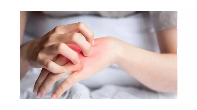 Sıcak Havalar Mantar Sorununu Tetikliyor: İşte Korunma ve Tedavi Yöntemleri!