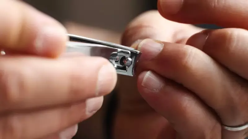 Tırnaklarınızdaki Gizemli Çukurlar: Eklem İltihabının Şaşırtıcı İşareti Olabilir!