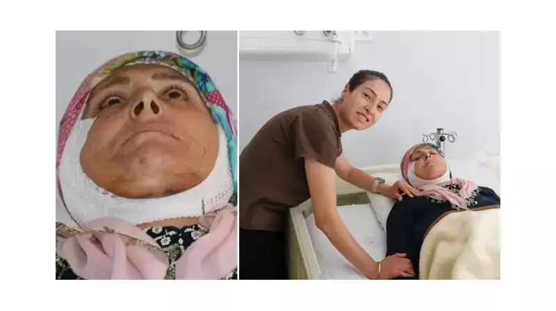 15 Yıllık Yüz Felci Kabusu Ameliyatla Son Buldu! İşte O Mucizevi Anlar