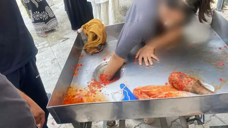 Şanlıurfa'da Feci Kaza! 16 Yaşındaki Genç Kızın Eli Makineye Sıkıştı