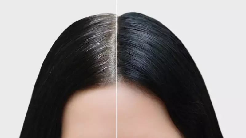 Beyaz Saçlara Son Mu? Çin'de Patlayan 'Mucize İğne' Gerçek Mi Yoksa Büyük Bir Aldatmacı Mı?