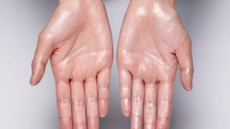 Ellerdeki Aşırı Terleme Kabusu Sona Erdi! Uzmanlar Yüz Güldüren Gelişmeyi Açıkladı