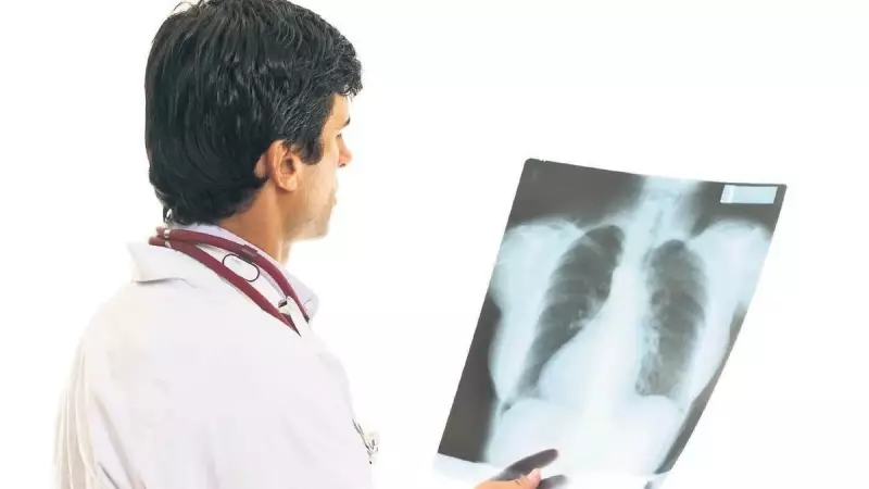 Şiddetli Öksürük Kaburga Kırığına Yol Açabilir! İşte Dikkat Edilmesi Gerekenler