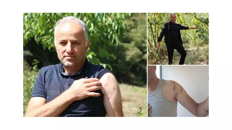 Muğla'da Korkunç Ayı Saldırısı: Baba Yüzünden Tanınmaz Hale Geldi, Oğlunun Parmağı Koptu!