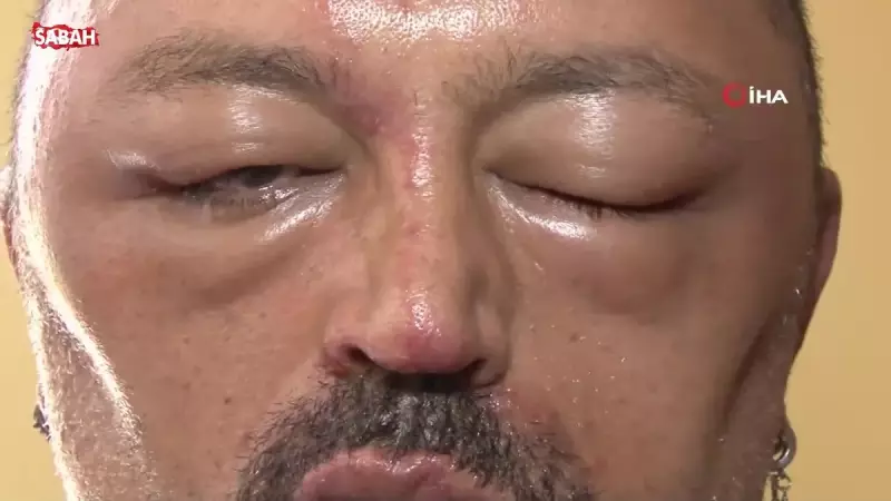 İnternetten Aldığı Şampuan Adeta Bir Kabusa Dönüştü: 'Gözlerimi Kaybedeceğim Diye Çok Korktum'