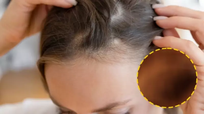 Saç Dökülmesine Çare Gibi Ürün! İlk Yıkamada Etkisini Gösteriyor