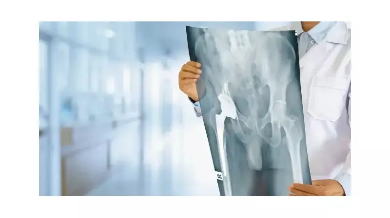 Avasküler Nekroz: Eklemlerin Sessiz Çığlığına Kulak Verin! Erken Teşhis Hayat Kurtarıyor