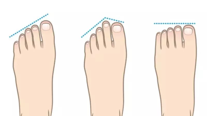 Ayak Şekliniz Karakterinizi Ele Veriyor! Hangi Tip Sizsiniz?