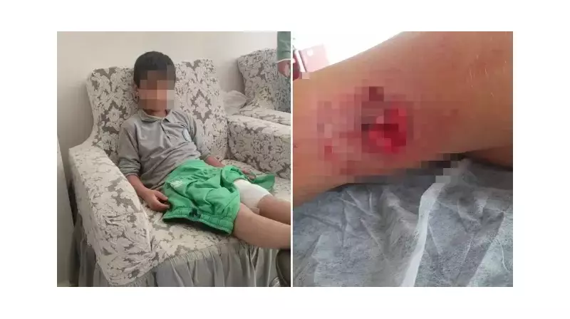 Bursa'da Sokak Köpeği Saldırısı: Çocuk Yaralandı!