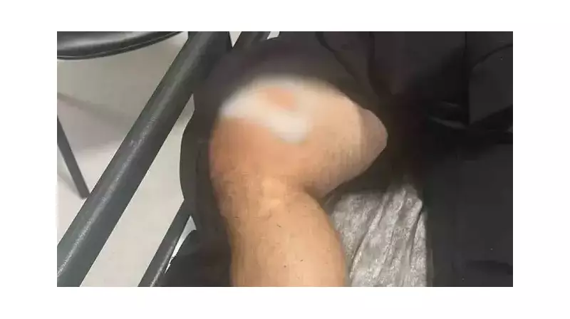 Kardeş Kavgası Silahlı Çatışmaya Dönüştü: Bir Yaralı!