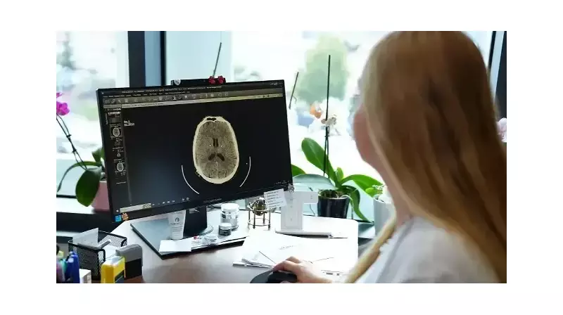 Küme Baş Ağrısı: 'İntihar Migreni' Olarak Bilinen Dayanılmaz Ağrıyı Tanıyor musunuz?