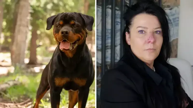 Korkunç Saldırı: Arkadaşının Köpeği Burnunu Parçaladı, 8 Ay Pipetle Yaşadı!