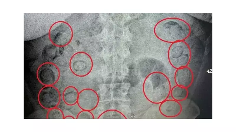 Midesinden 433 Gram Metamfetamin Çıktı! Adana'da Nefes Kesen Narkotik Operasyonu