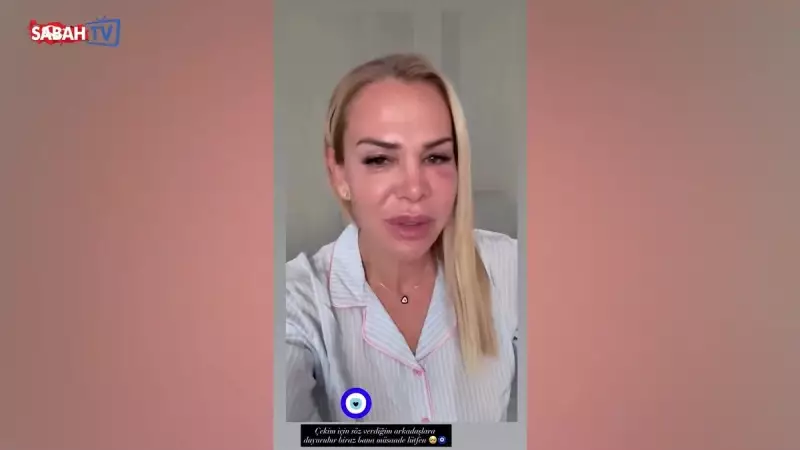 Nagihan Karadere'nin Gözündeki Morluk Sevenlerini Endişelendirdi! İşte Gerçek Nedeni