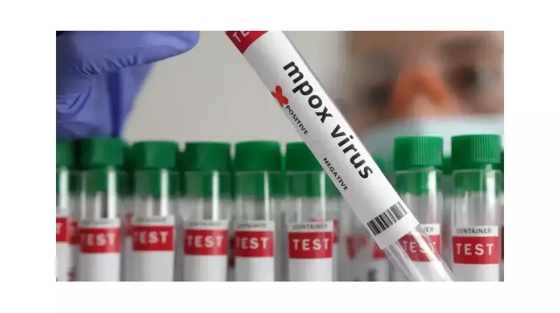 Şok Açıklama: İlk Vaka Tespit Edildi! Hem Hayvandan Hem İnsandan Bulaşıyor