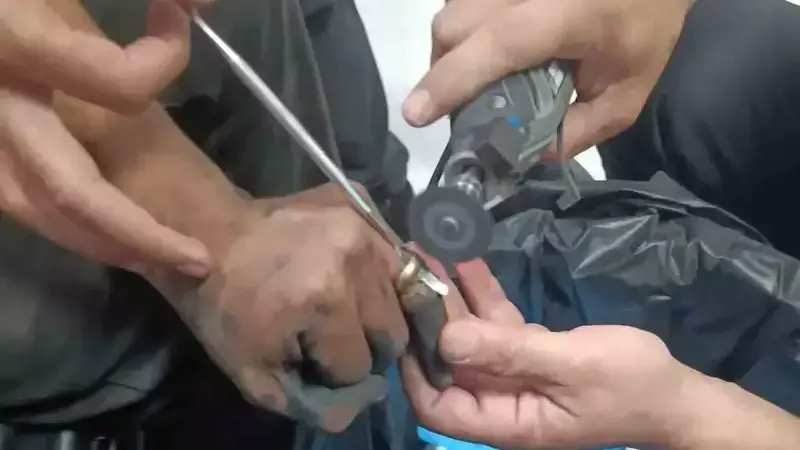 Yüzük Parmakta Sıkıştı! Doktor ve İtfaiye Ekiplerinden İlginç Kurtarma Operasyonu