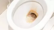 Temizlik Uzmanlarından Şok Uyarı: Çamaşır Suyu Tuvalet Kapaklarını Sarartıyor!